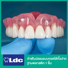 ทำฟันปลอมแบบถอดได้ทั้งปาก ฐานพลาสติก 1 ชิ้น ฟันบนหรือล่าง