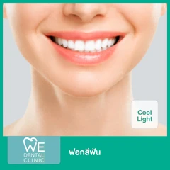 ฟอกสีฟัน ด้วยระบบ Cool Light
