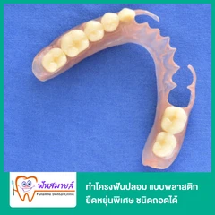 ทำโครงฟันปลอม แบบพลาสติกยืดหยุ่นพิเศษ ชนิดถอดได้ พร้อมฟันซี่แรก 1 ซี่