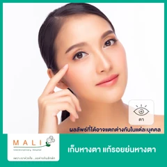 เก็บหางตา แก้รอยย่นหางตา 1 ครั้ง