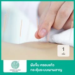 ฝังเข็ม ครอบแก้ว กระตุ้นระบบเผาผลาญ 1 ครั้ง