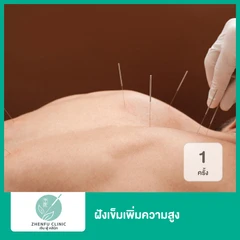 ฝังเข็มเพิ่มความสูง 1 ครั้ง