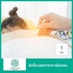 ฝังเข็มบรรเทาอาการไมเกรน 1 ครั้ง