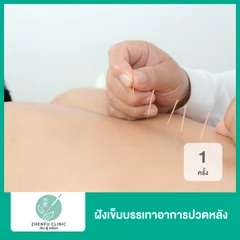 ฝังเข็มบรรเทาอาการปวดหลัง 1 ครั้ง