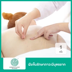 ฝังเข็มรักษาภาวะมีบุตรยาก 1 ครั้ง