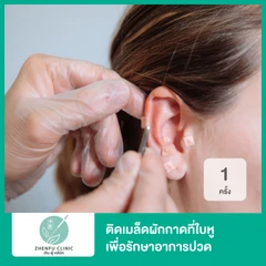 ติดเมล็ดผักกาดที่ใบหู เพื่อรักษาอาการปวด 1 ครั้ง
