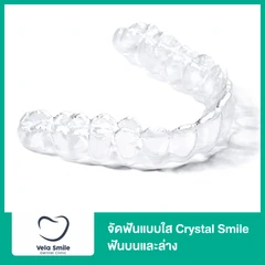 จัดฟันแบบใส Crystal Smile Moderate ฟันบนและล่าง