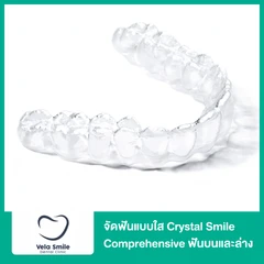จัดฟันแบบใส Crystal Smile Comprehensive ฟันบนและล่าง
