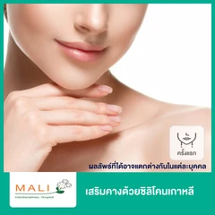 เสริมคางด้วยซิลิโคนเกาหลี สำหรับเคสทำครั้งแรก