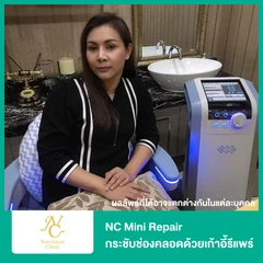 NC Mini Repair กระชับช่องคลอดด้วยเก้าอี้รีแพร์ 1 ครั้ง