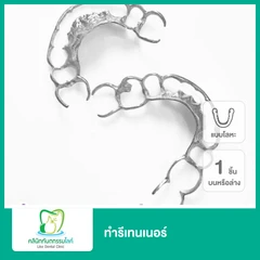 ทำรีเทนเนอร์แบบโลหะ 1 ชิ้น ฟันบนหรือล่าง