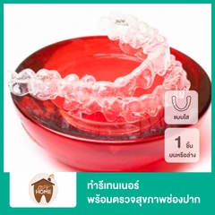 ทำรีเทนเนอร์แบบใส 1 ชิ้น ฟันบนหรือล่าง พร้อมตรวจสุขภาพช่องปาก