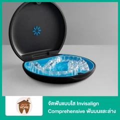 จัดฟันแบบใส Invisalign Go ฟันบนและล่าง