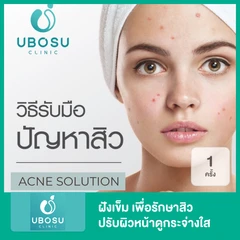 ฝังเข็ม เพื่อรักษาสิว ปรับผิวหน้าดูกระจ่างใส 1 ครั้ง