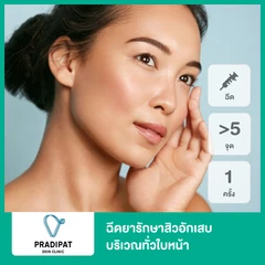 ฉีดยารักษาสิวอักเสบ 5 จุดขึ้นไป บริเวณทั่วใบหน้า 1 ครั้ง