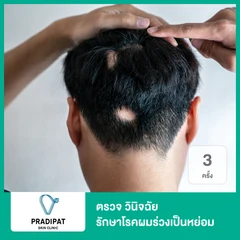 ตรวจ วินิจฉัย รักษาโรคผมร่วงเป็นหย่อม 3 ครั้ง