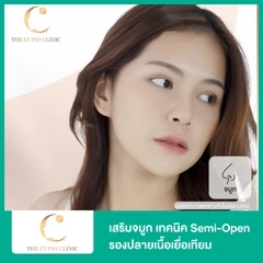 เสริมจมูก ด้วยซิลิโคนอเมริกาพรีเมียมแบบนิ่มบิดได้ รองปลายเนื้อเยื่อเทียม เทคนิค Semi-Open