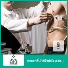 ตรวจคลื่นไฟฟ้าหัวใจ (EKG)