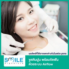 ขูดหินปูน พร้อมขัดฟันด้วยระบบ Airflow