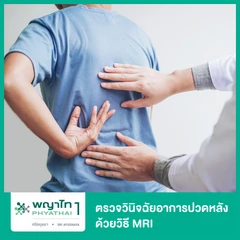 ตรวจวินิจฉัยอาการปวดหลังที่สาเหตุ ด้วยวิธี MRI