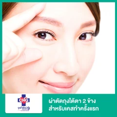 ผ่าตัดถุงใต้ตา 2 ข้าง สำหรับเคสทำครั้งแรก