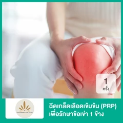 ฉีดเกล็ดเลือดเข้มข้น (PRP) เพื่อรักษาข้อเข่า 1 ข้าง 1 ครั้ง