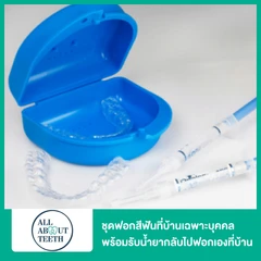 ชุดฟอกสีฟันที่บ้าน ทำชุดฟอกสีฟันเฉพาะบุคคล พร้อมรับน้ำยากลับไปฟอกเองที่บ้าน