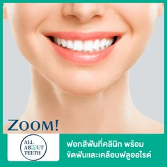 ฟอกสีฟันที่คลินิก ด้วยระบบ Zoom พร้อมขัดฟันและเคลือบฟลูออไรด์
