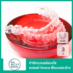 ทำรีเทนเนอร์แบบใส แบรนด์ Vivera จาก Invisalign ฟันบนและล่าง (3 คู่ 6 ชิ้นงาน)