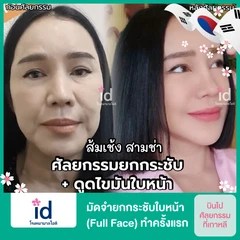 มัดจำยกกระชับใบหน้า (Full Face) สำหรับเคสทำครั้งแรก