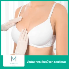 ผ่าตัดยกกระชับหน้าอก รวมหัวนม