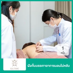 ฝังเข็มบรรเทาอาการนอนไม่หลับ 1 ครั้ง