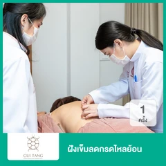 ฝังเข็มลดกรดไหลย้อน 1 ครั้ง