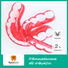 ทำรีเทนเนอร์แบบลวด 2 ชิ้น ฟันบนและล่าง ฟรี! ค่าพิมพ์ปาก