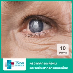 ตรวจคัดกรองต้อหิน และจอประสาทตาแบบละเอียด 10 รายการ