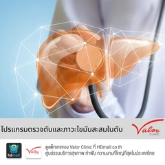 ตรวจภาวะพังผืดในตับและไขมันพอกตับ ด้วยเครื่องไฟโบรสแกน (FibroScan)
