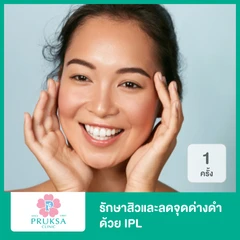รักษาสิวและลดจุดด่างดำ ด้วย IPL (โปรแกรม Acne and Dark Spots) 1 ครั้ง