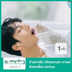 ทำสปาฟัน ขจัดคราบชา กาแฟ ด้วยเครื่อง Airflow 1 ครั้ง