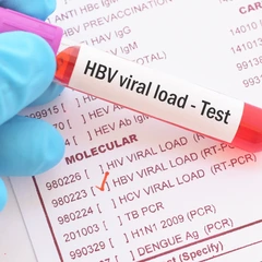 ตรวจเลือดหาภูมิคุ้มกันต่อไวรัสตับอักเสบบี แบบบริการถึงบ้าน (เฉพาะพื้นที่ในกรุงเทพมหานคร)