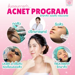 รักษาสิว พร้อมเลเซอร์เพื่อผิวกระจ่างใส (Acnet Program) 1 ครั้ง