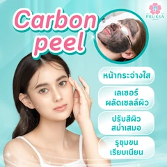 เลเซอร์ Carbon Peel เพื่อผลัดเซลล์ผิว กระตุ้นการสร้างคอลลาเจน 1 ครั้ง