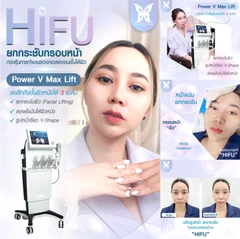 ทำ HIFU จำนวนช็อตขึ้นอยู่กับแพทย์ประเมิน บริเวณทั่วใบหน้า 1 ครั้ง