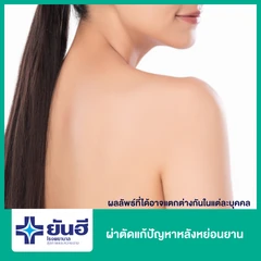 ผ่าตัดแก้ปัญหาหลังหย่อนยาน พักฟื้นที่รพ. 2 คืน