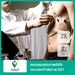 ตรวจสมรรถภาพหัวใจขณะออกกำลังกาย (EST) (15 ปีขึ้นไป)
