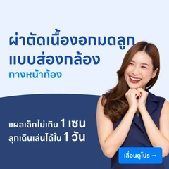 ผ่าตัดเนื้องอกมดลูก (แบบส่องกล้องทางหน้าท้อง)
