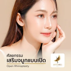 เสริมจมูกด้วยซิลิโคนเกาหลี เทคนิค Open Rhinoplasty สำหรับเคสทำครั้งแรก นอนพักที่ รพ. 2 คืน