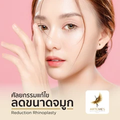 ศัลยกรรมลดขนาดจมูกให้เล็กลง Reduction Rhinoplasty สำหรับเคสทำครั้งแรก นอนพักที่ รพ. 2 คืน