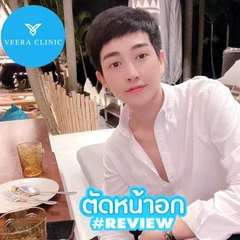 ตัดหน้าอก Mastectomy ขนาดคัพ D แบบแผลยาว สำหรับเคสทำครั้งแรก