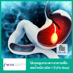 ใส่บอลลูนกระเพาะอาหารเพื่อลดน้ำหนัก Gastric Balloon ชนิด 1 ปี (ปรับขนาดได้) นอนพักที่ รพ. 1 คืน