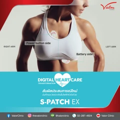 ตรวจติดตามและวิเคราะห์คลื่นไฟฟ้าหัวใจ ด้วย S-Patch EX 1 ครั้ง
